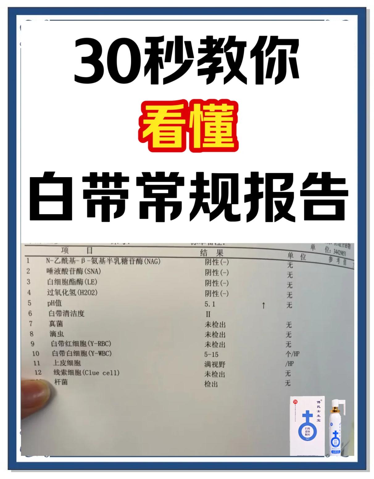 白带常规检查痛吗