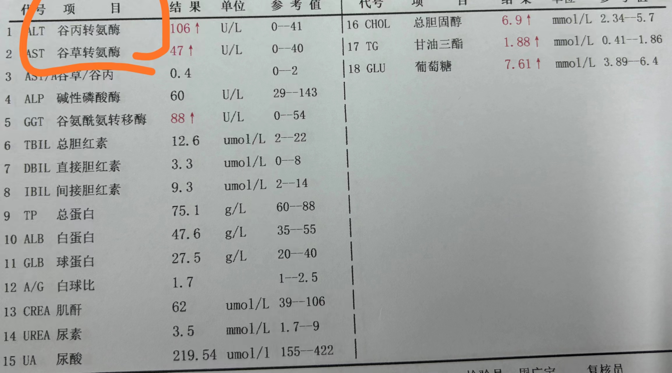 谷丙转氨酶高的症状有什么