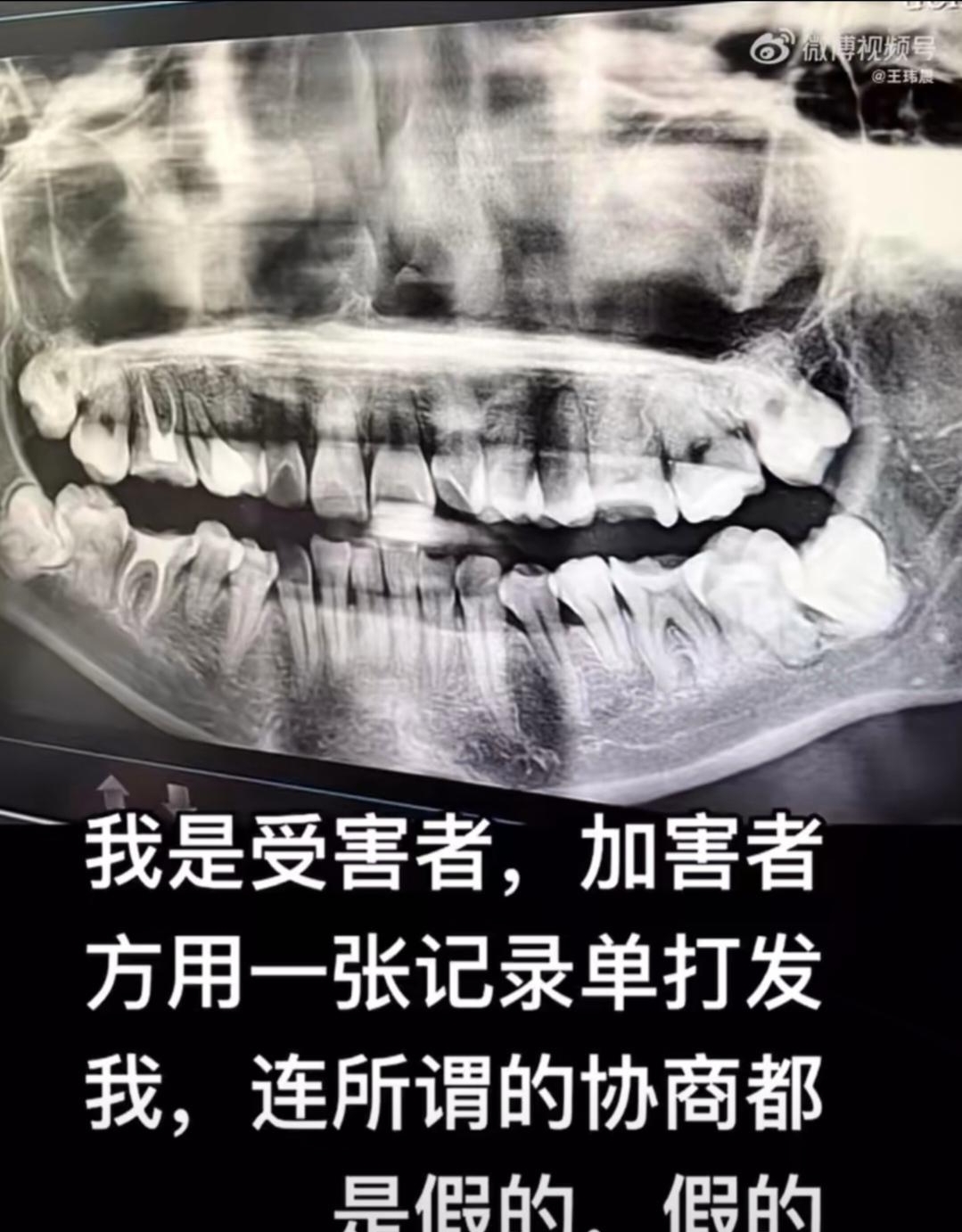 拔尽头牙对人的伤害