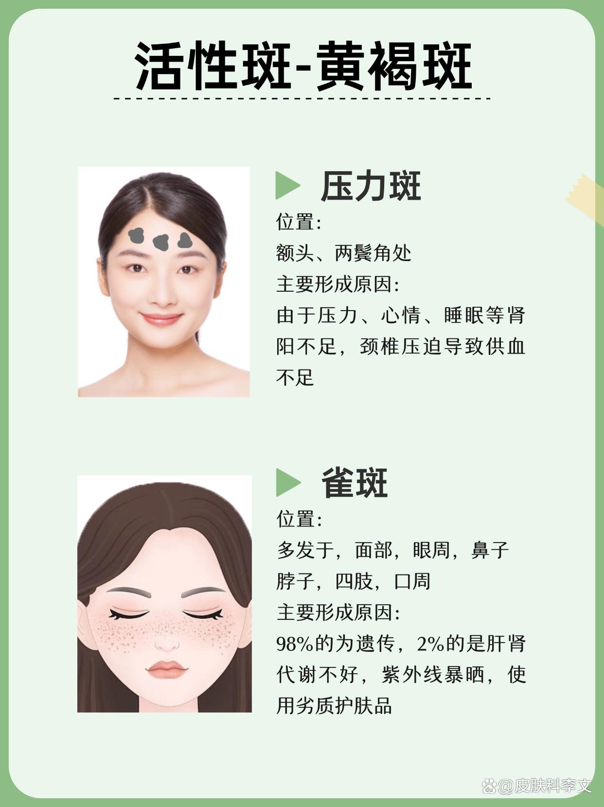 女人脸上长斑什么原因