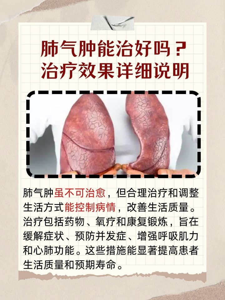 锐凝心 第3页