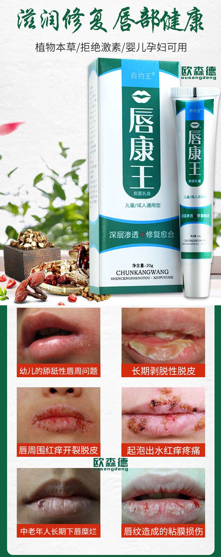 口周皮炎如何治疗