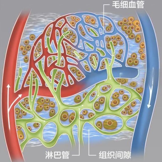 淋巴管炎怎么引起的?
