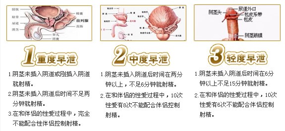 射精过快怎么办