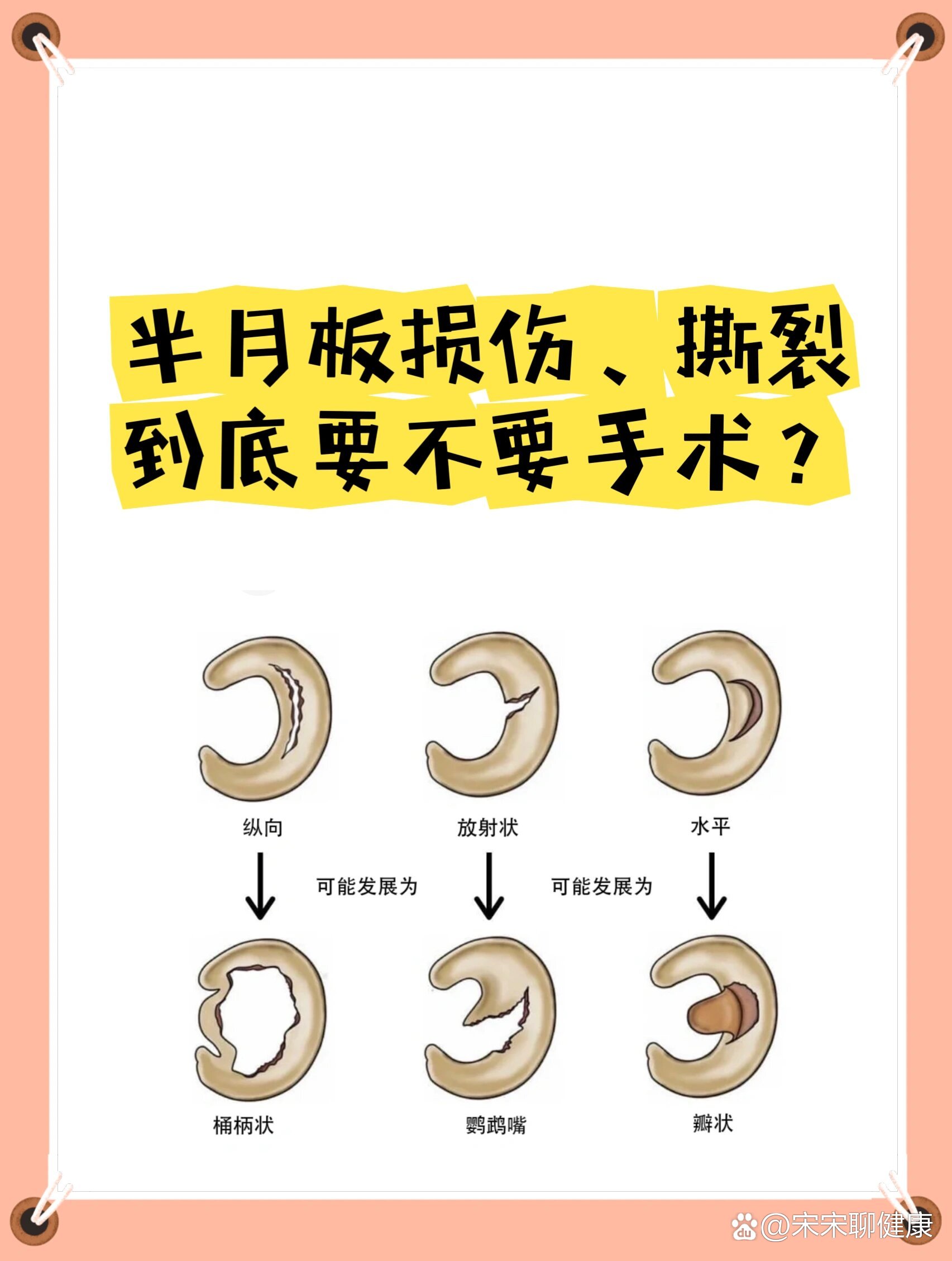 半月板损伤为什么要做关节镜手术