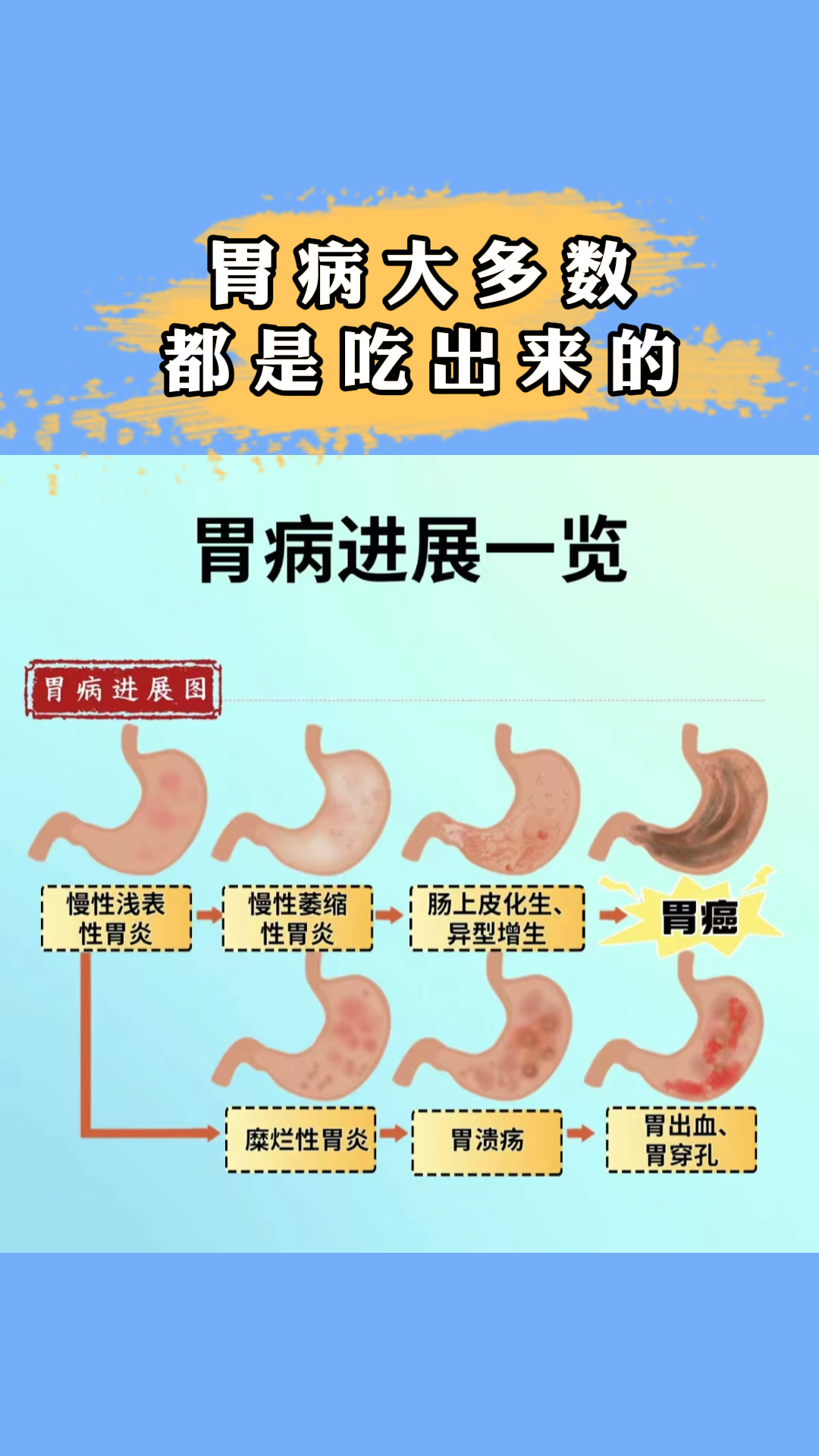 胃痛胃胀是什么原因