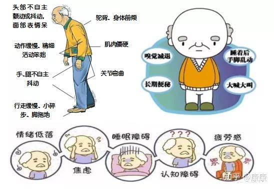 帕金森病是什么病