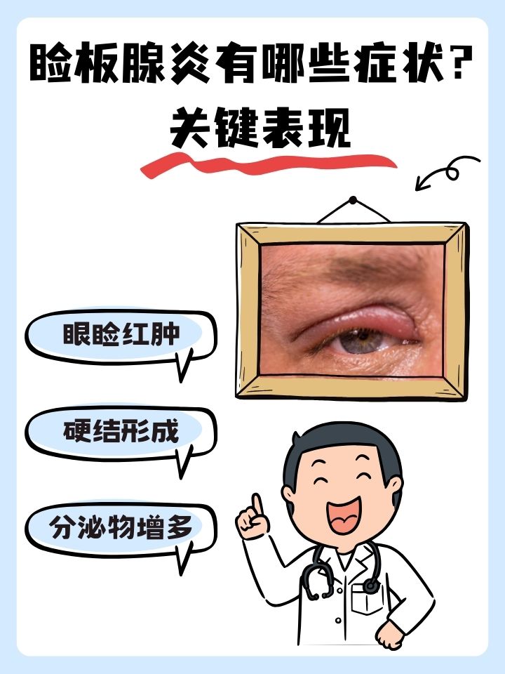 睑板腺在哪里?