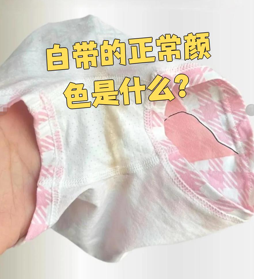 没有白带正常吗