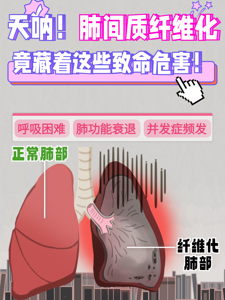肺纤维化可以治愈吗?