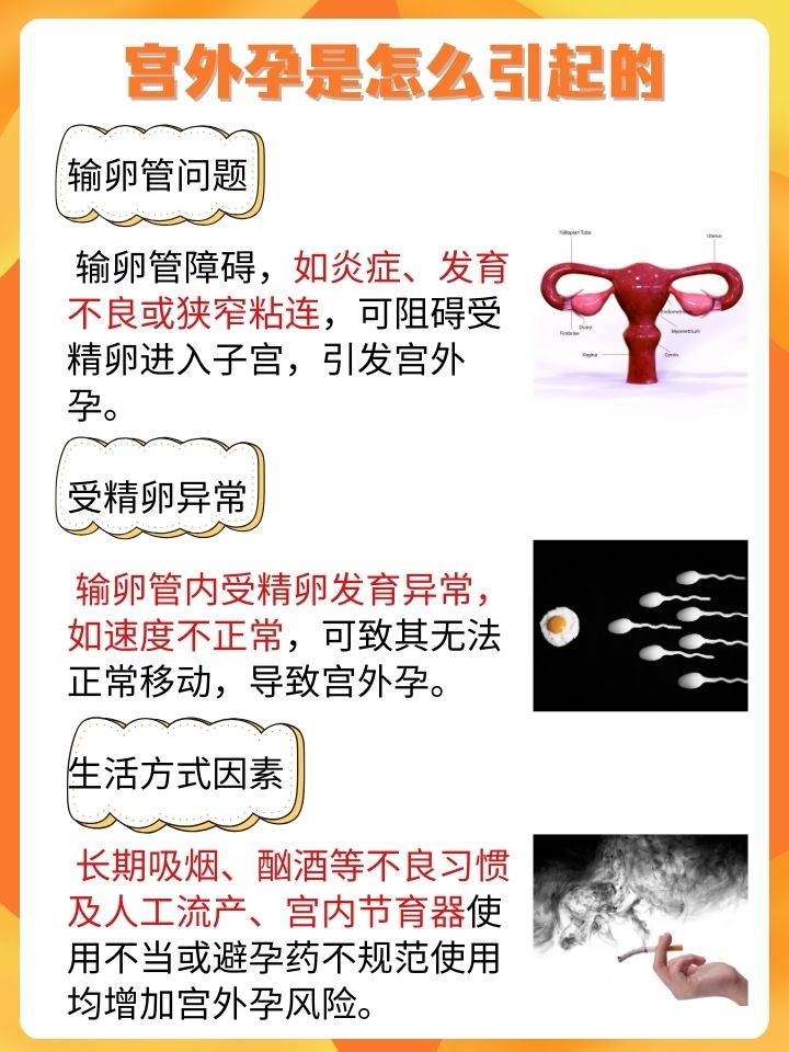 宫外孕是由什么原因引起的?