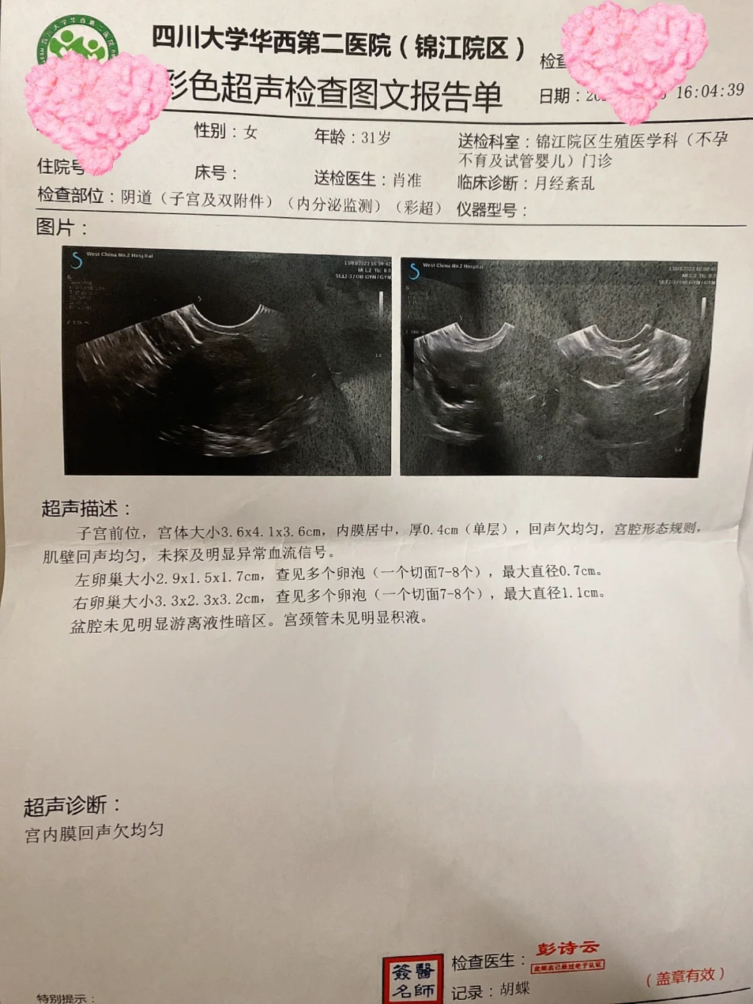 三个月没来月经,没怀孕