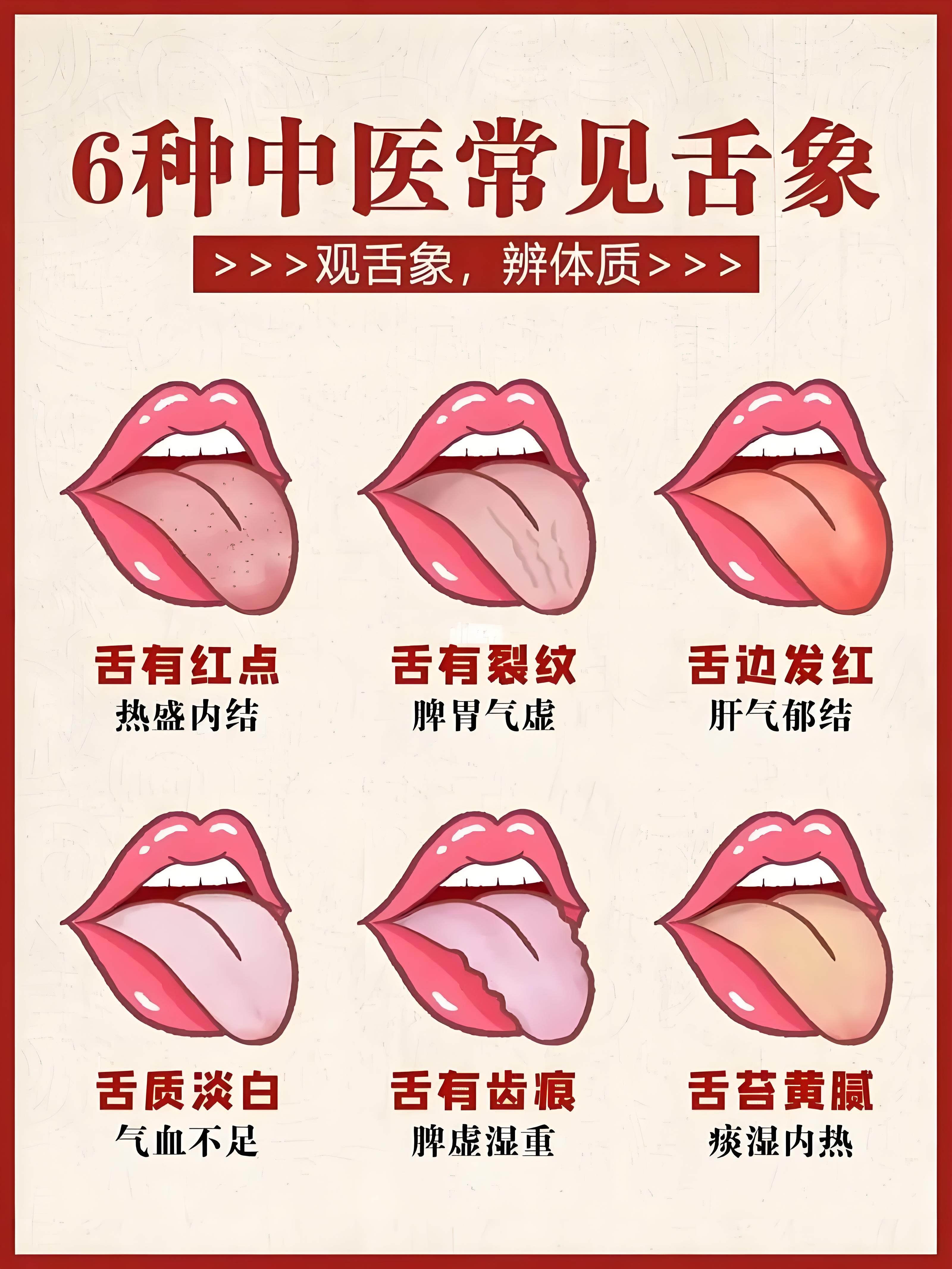 舌苔发白的原因