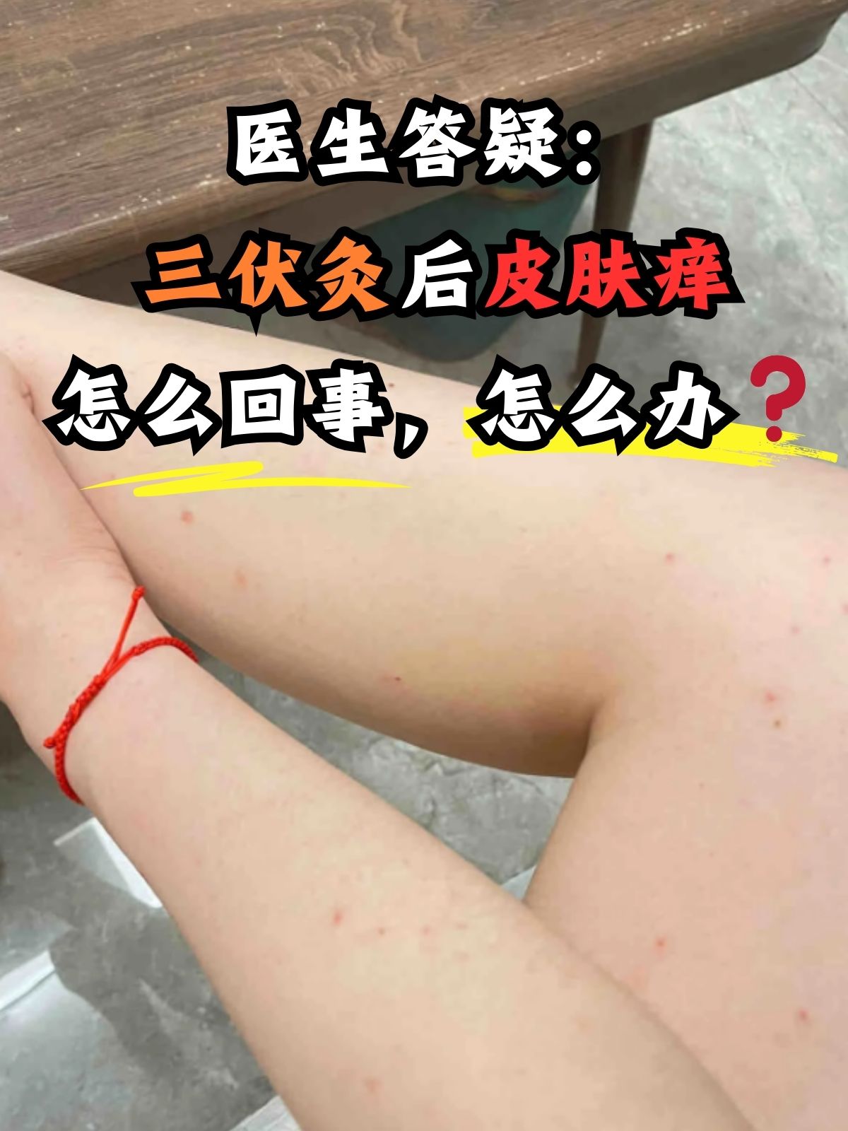 身上痒怎么办