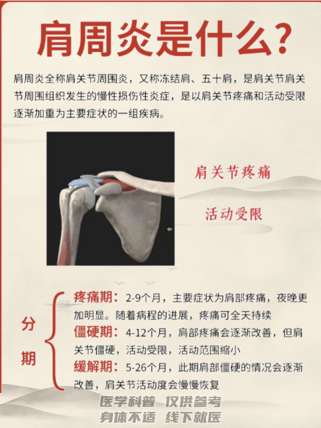 肩膀疼痛是怎么回事?