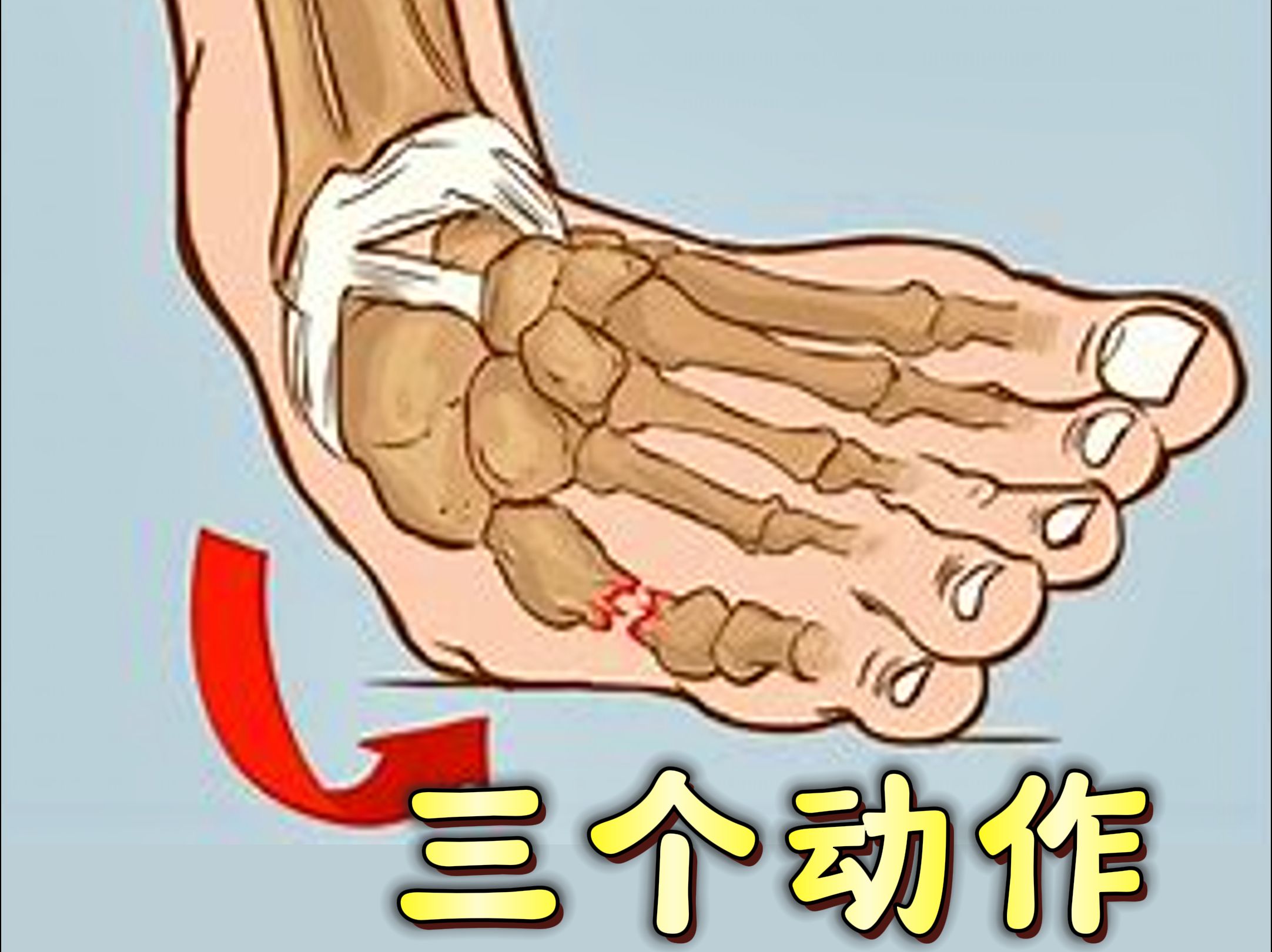 崴脚了,怎么可以快速消肿