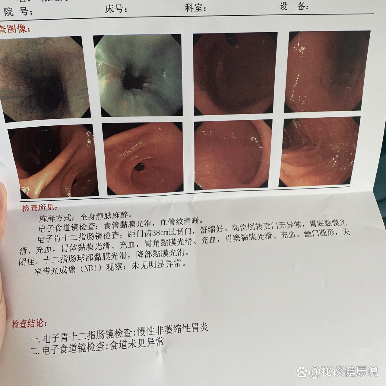 北京无痛胃镜