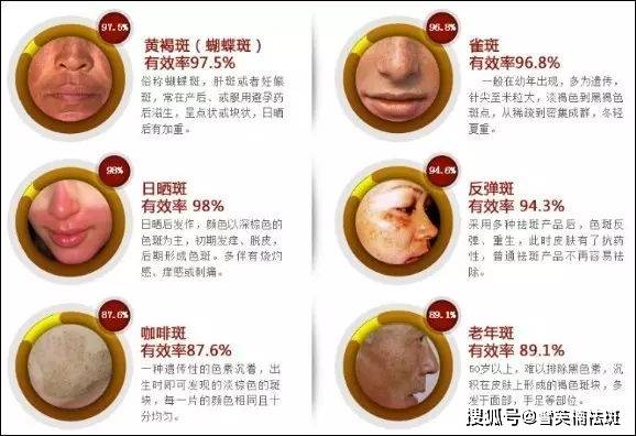 内分泌失调是什么意思?指什么?