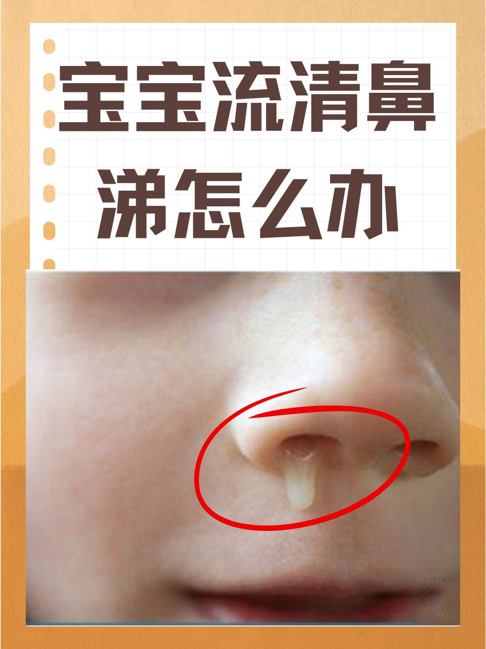 经常流清鼻涕,怎么治疗?