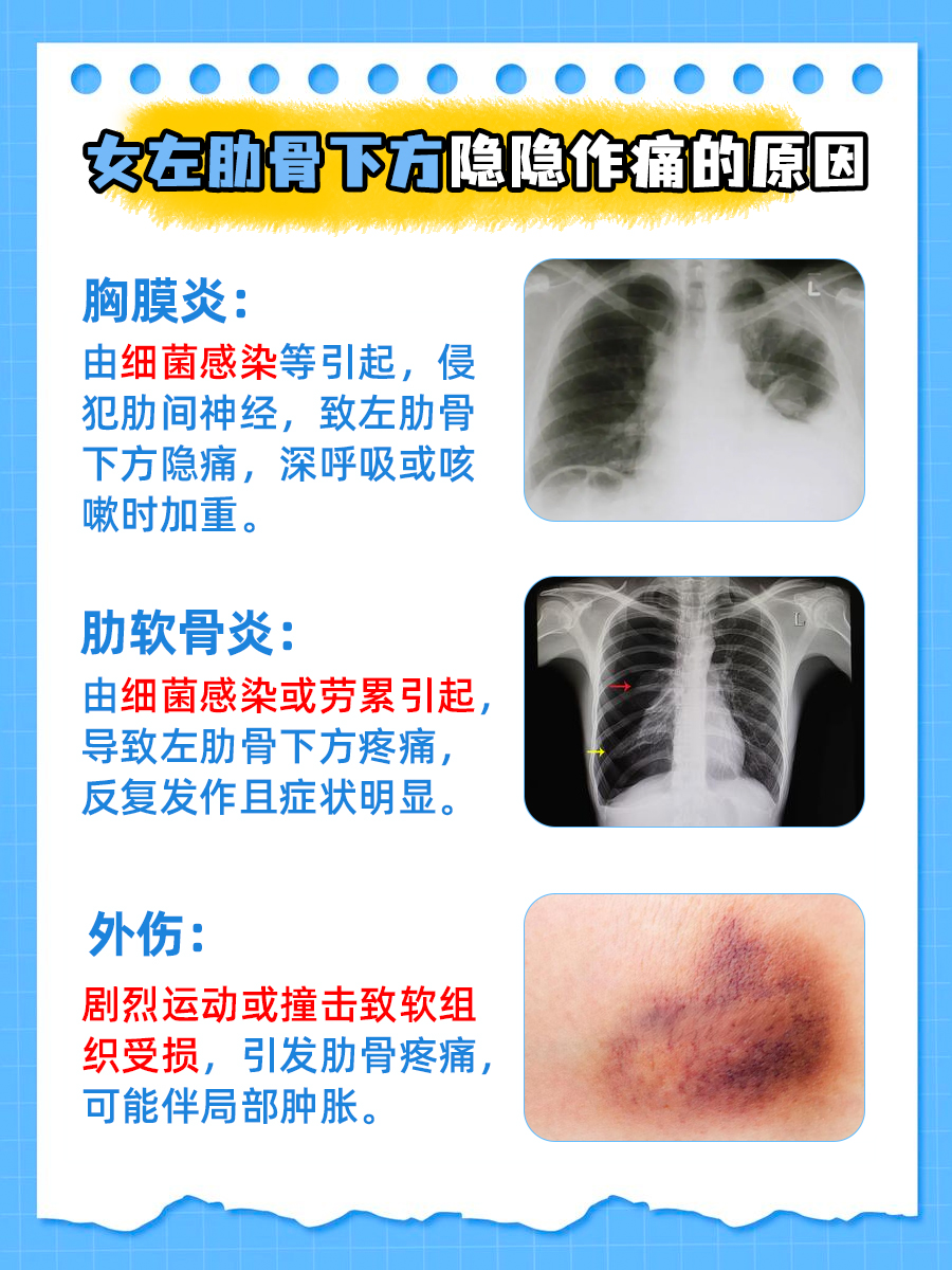 左肋骨疼怎么回事