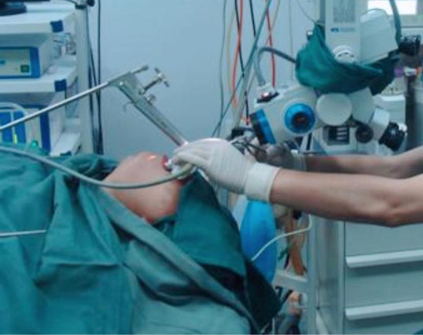 声带息肉手术危险吗?