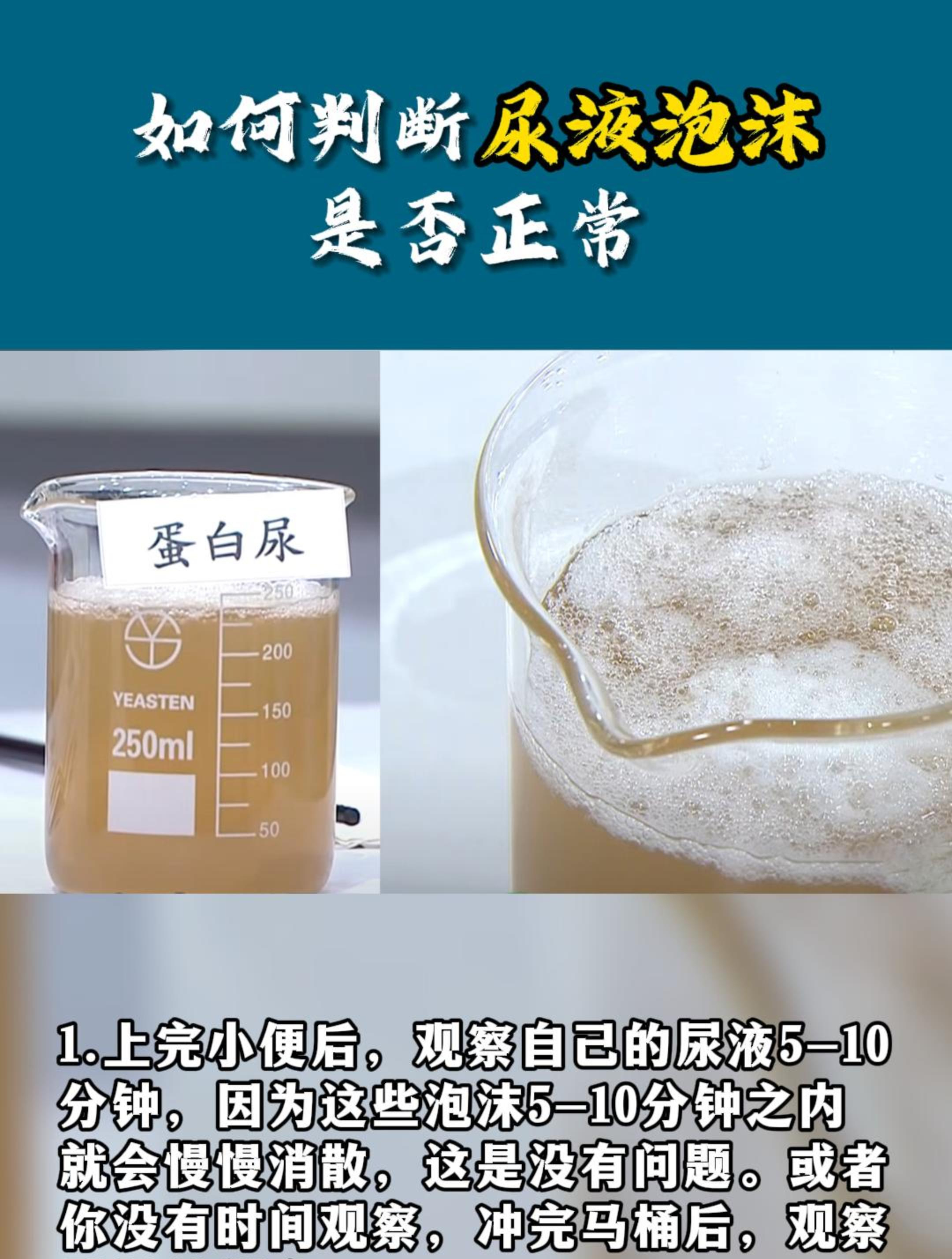 尿液里有泡沫是什么原因