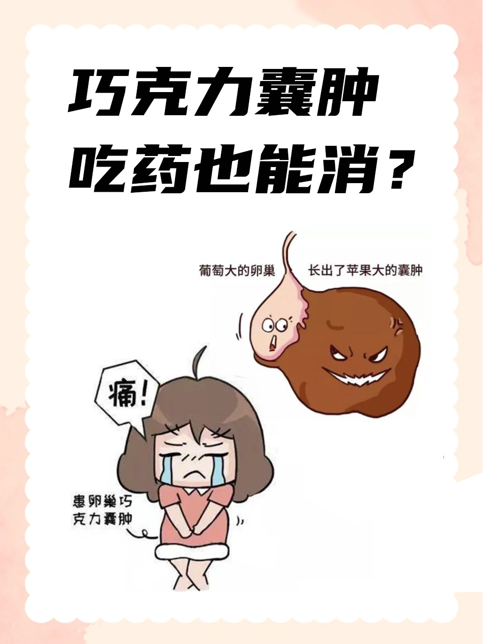 巧克力囊肿怎么治疗最好?