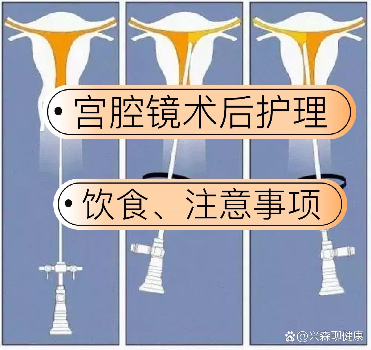 宫腔镜手术后注意事项