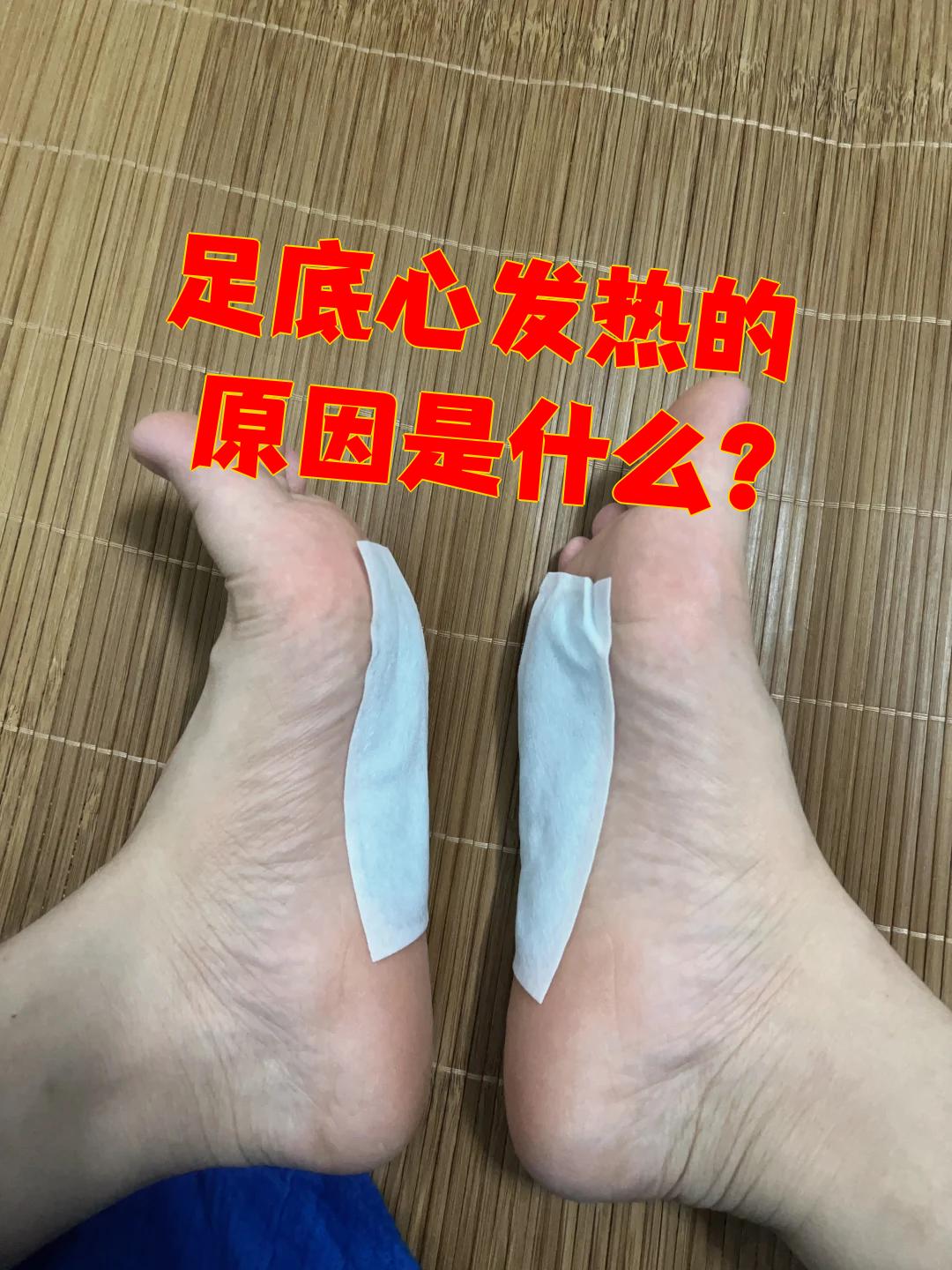 脚底发热是怎么回事