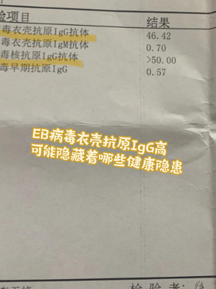 eb病毒是什么