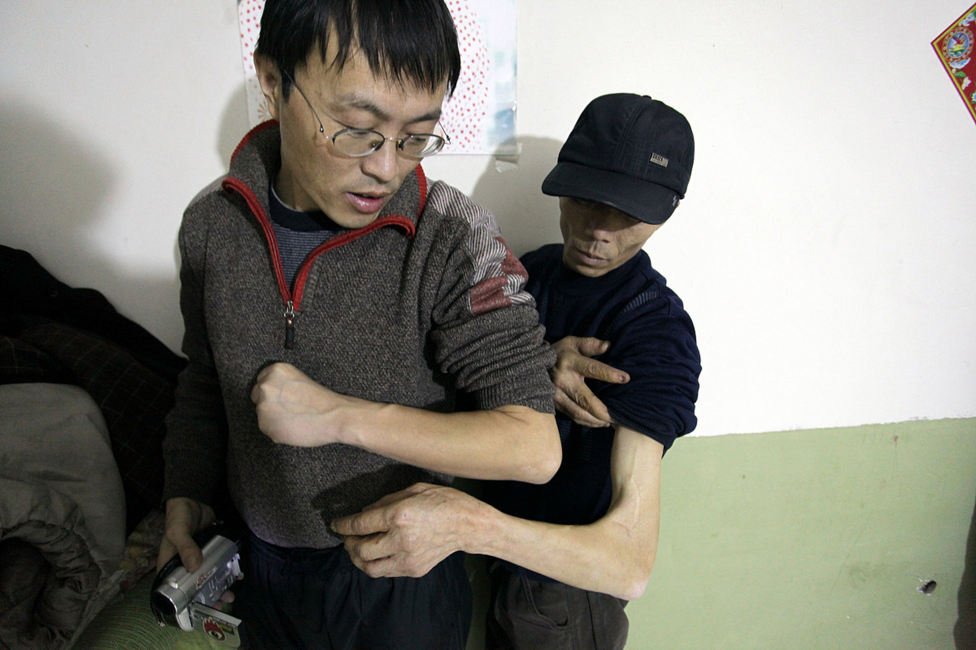 什么是偏瘫