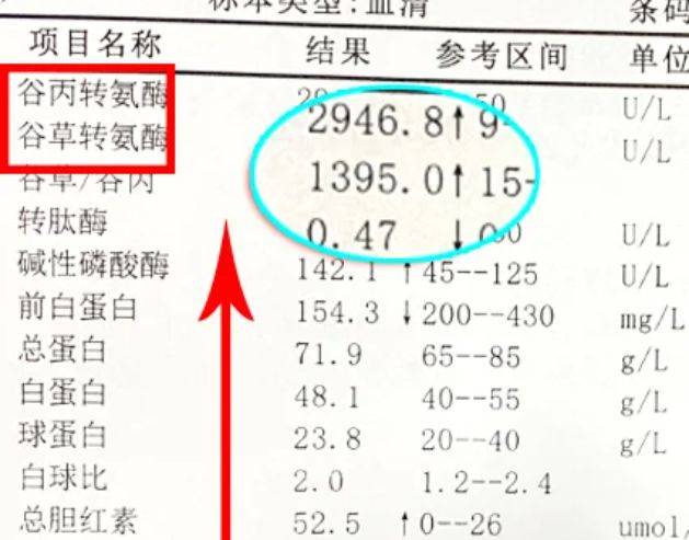 转氨酶高是怎么回事