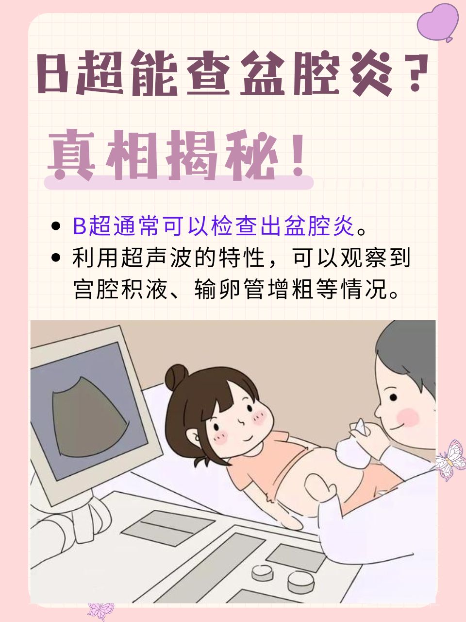 妇科检查一般查什么
