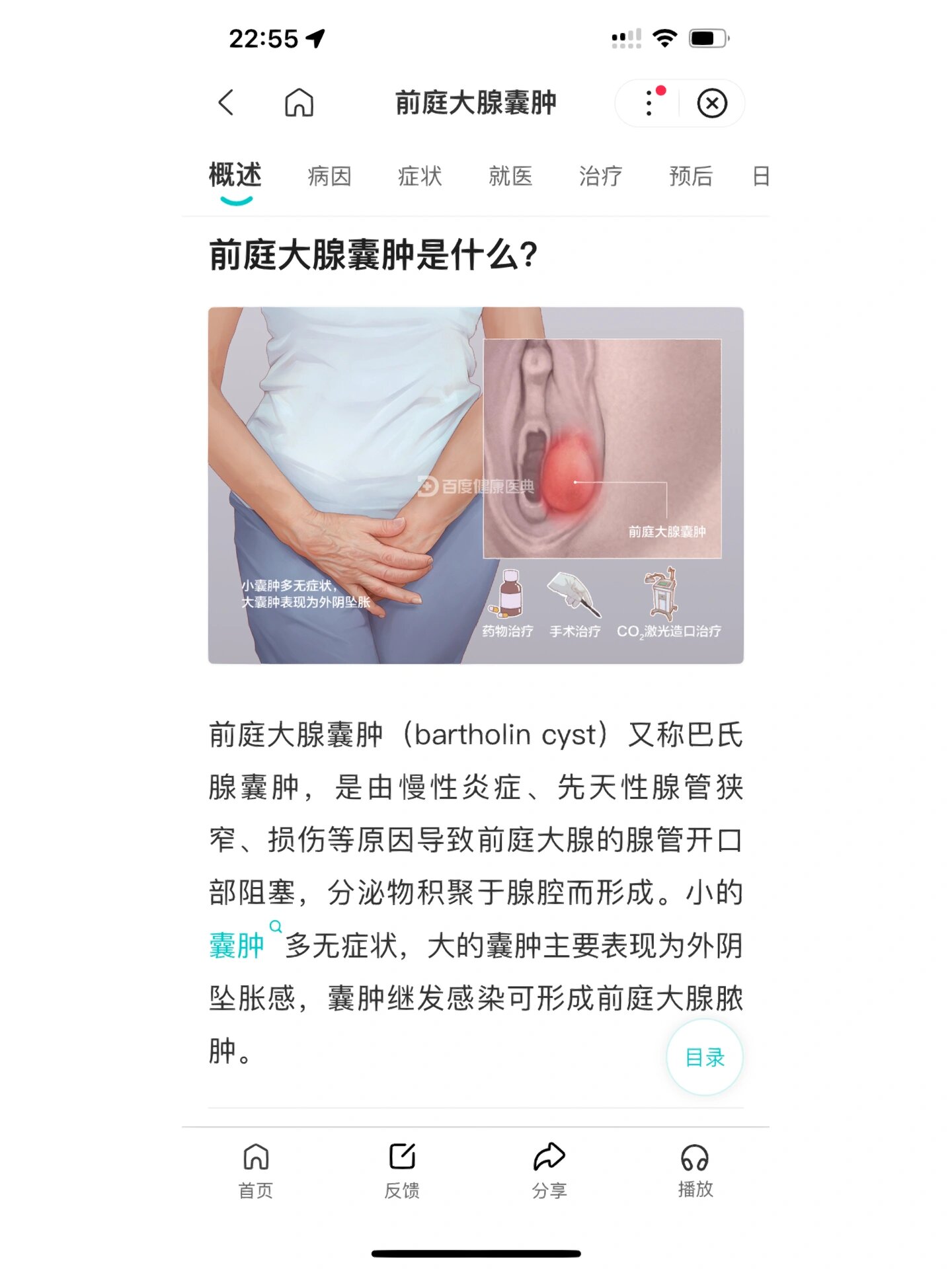 巴氏腺囊肿会自愈吗