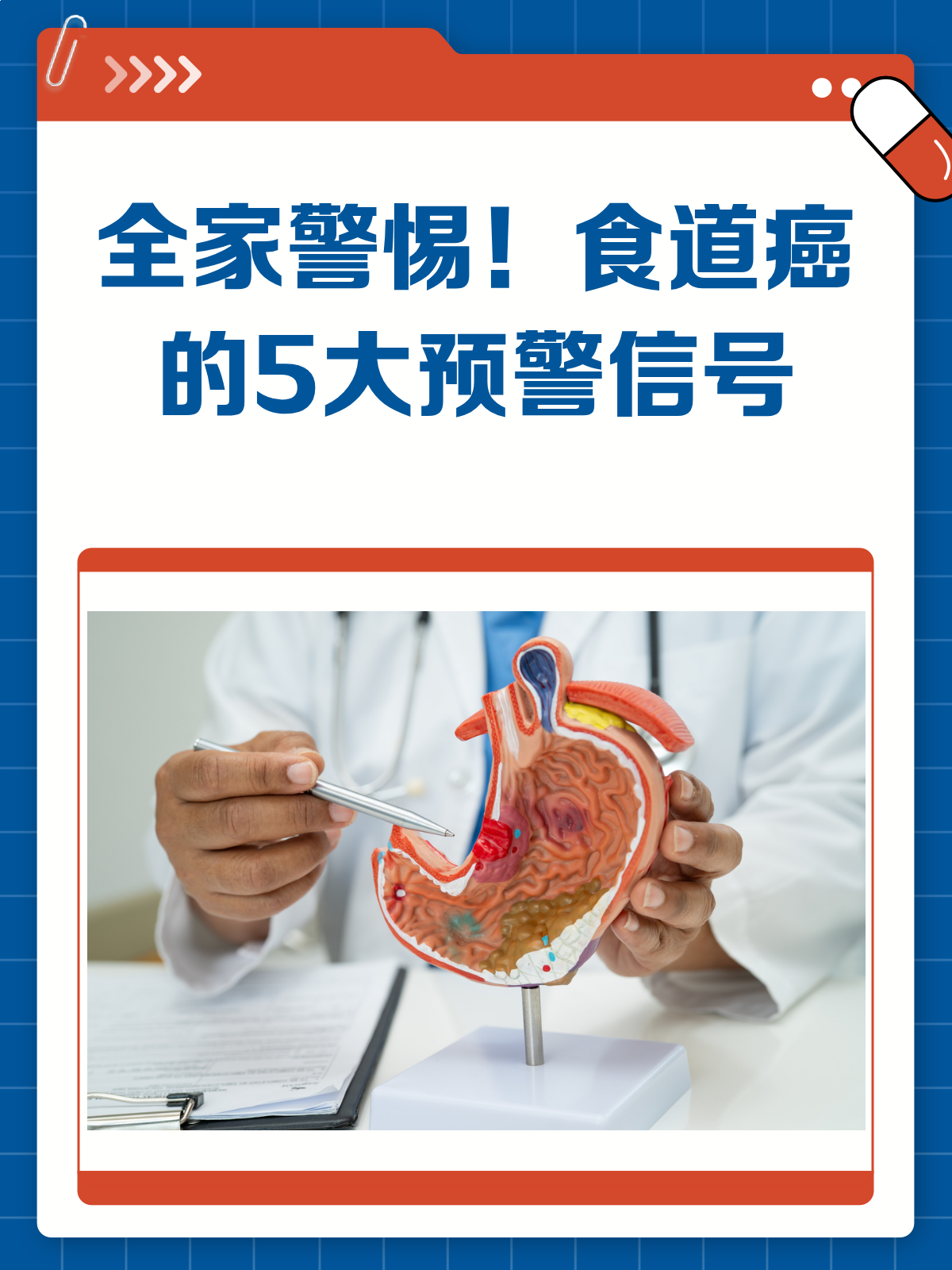 食道炎与食道癌的区别