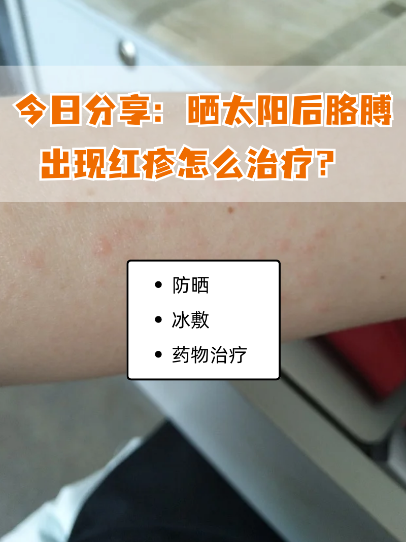 被太阳暴晒,皮肤发红怎么办?