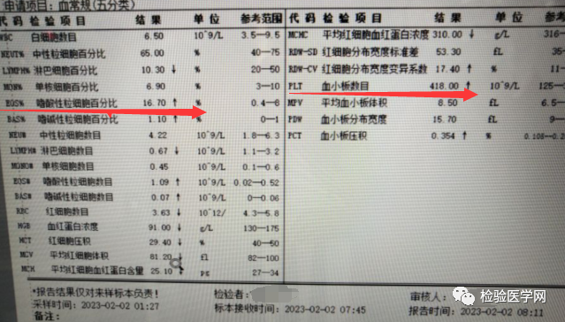 嗜酸性粒细胞比率低是什么原因