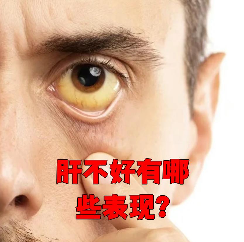 肝虚的症状有哪些表现