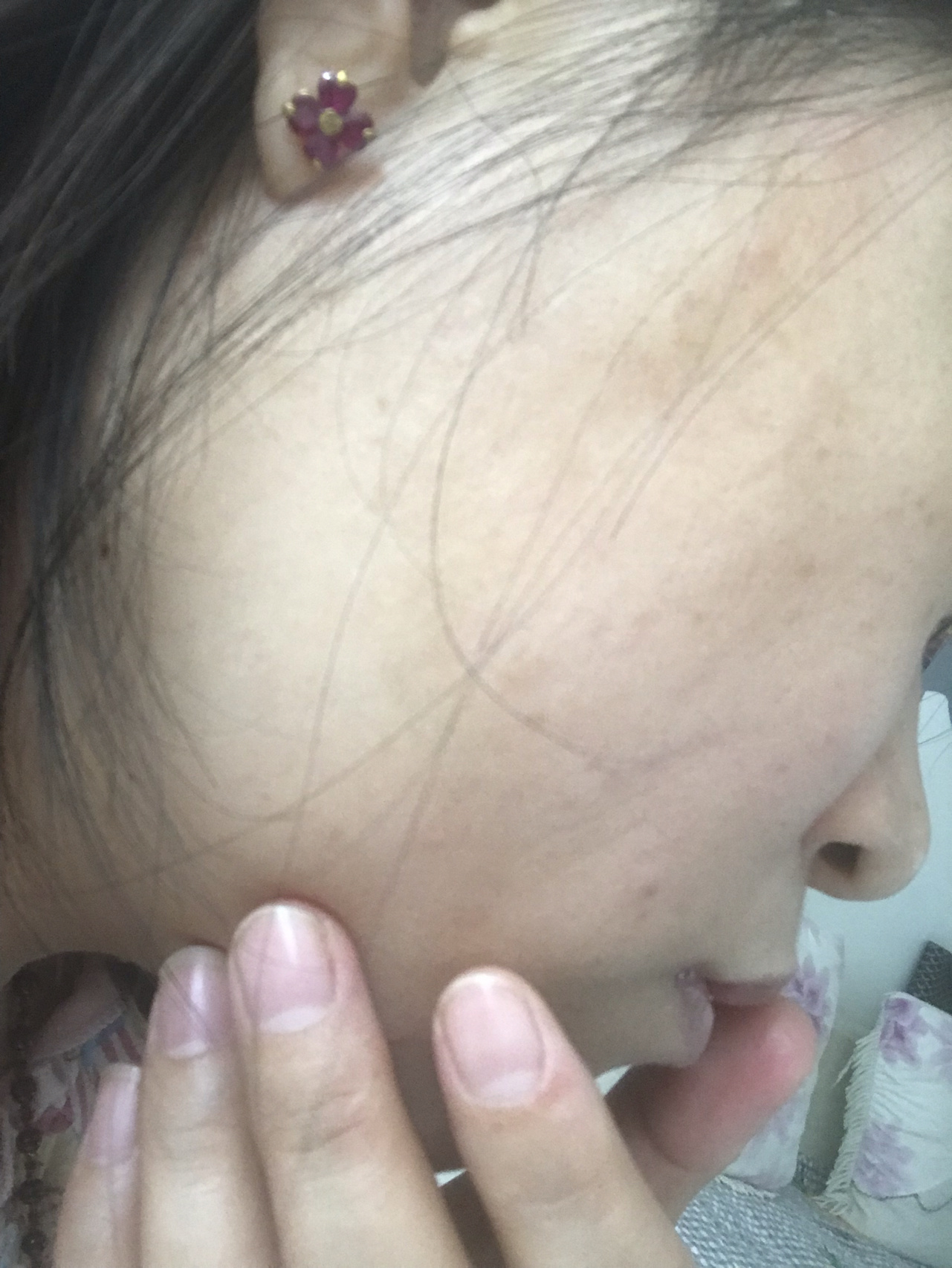 脸上长红疙瘩,不痛不痒