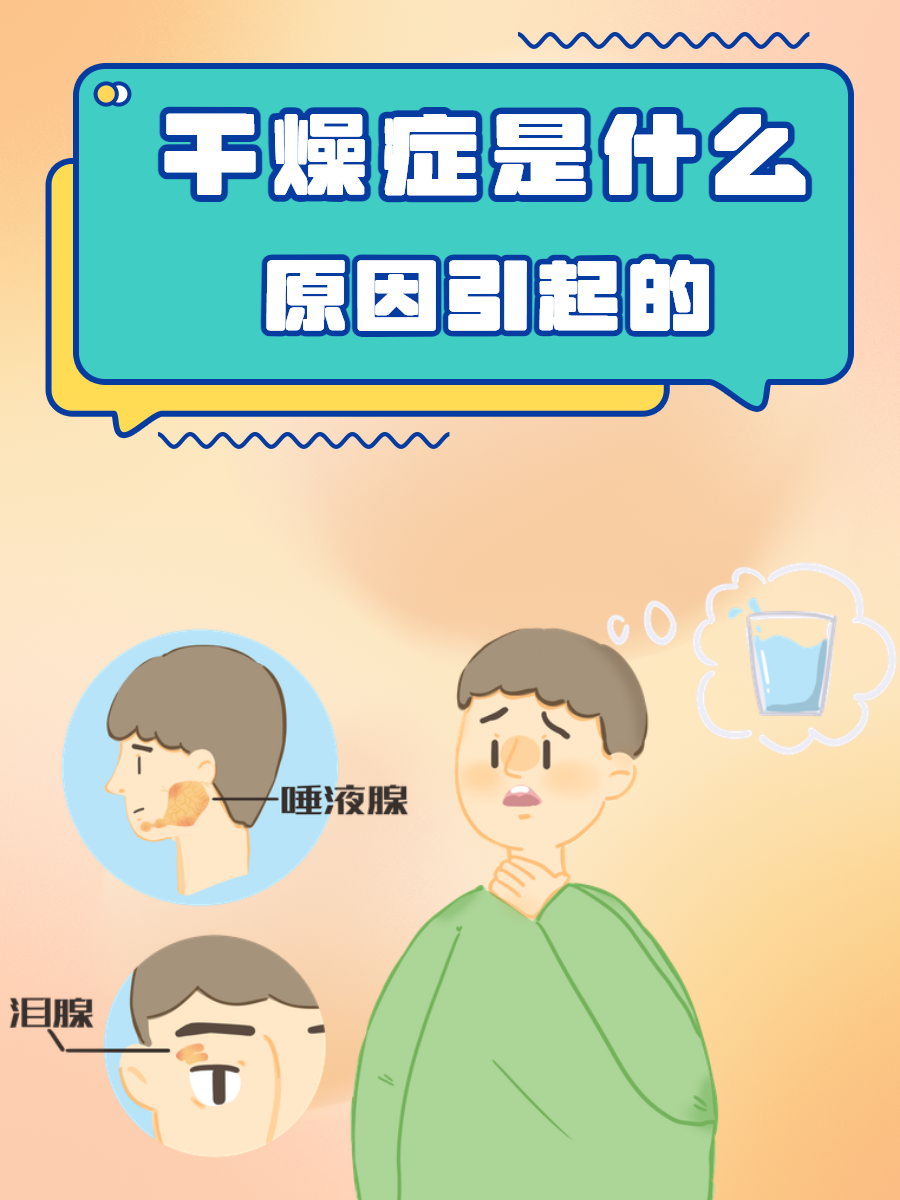 干燥综合征有哪些治疗方法
