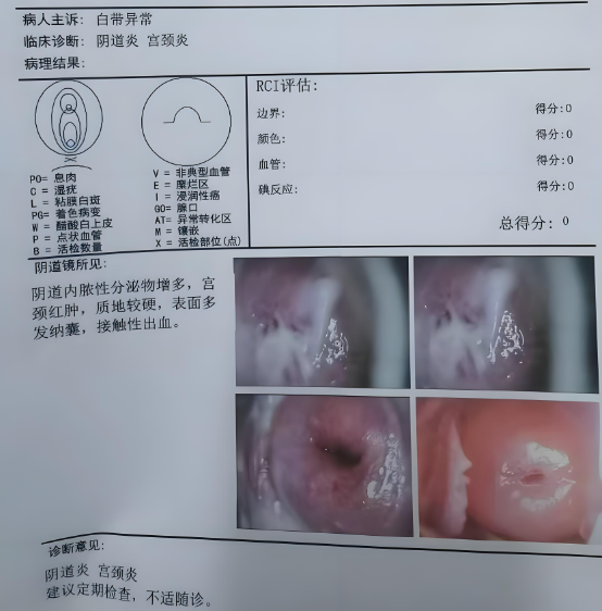 月经没来白带增多是怎么回事?
