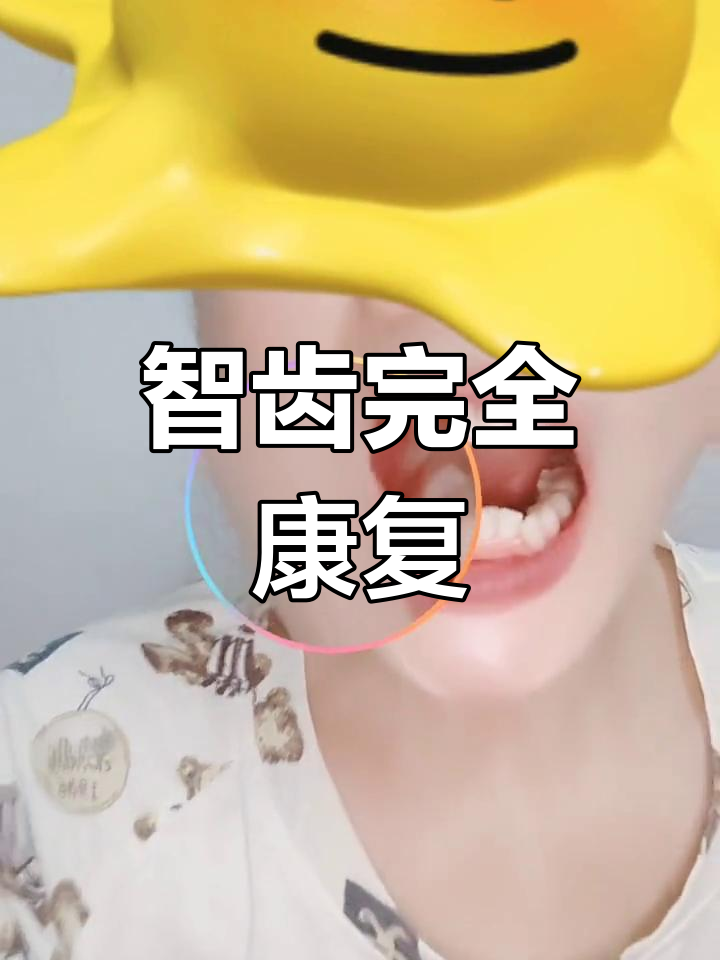 拔完智齿疼多久