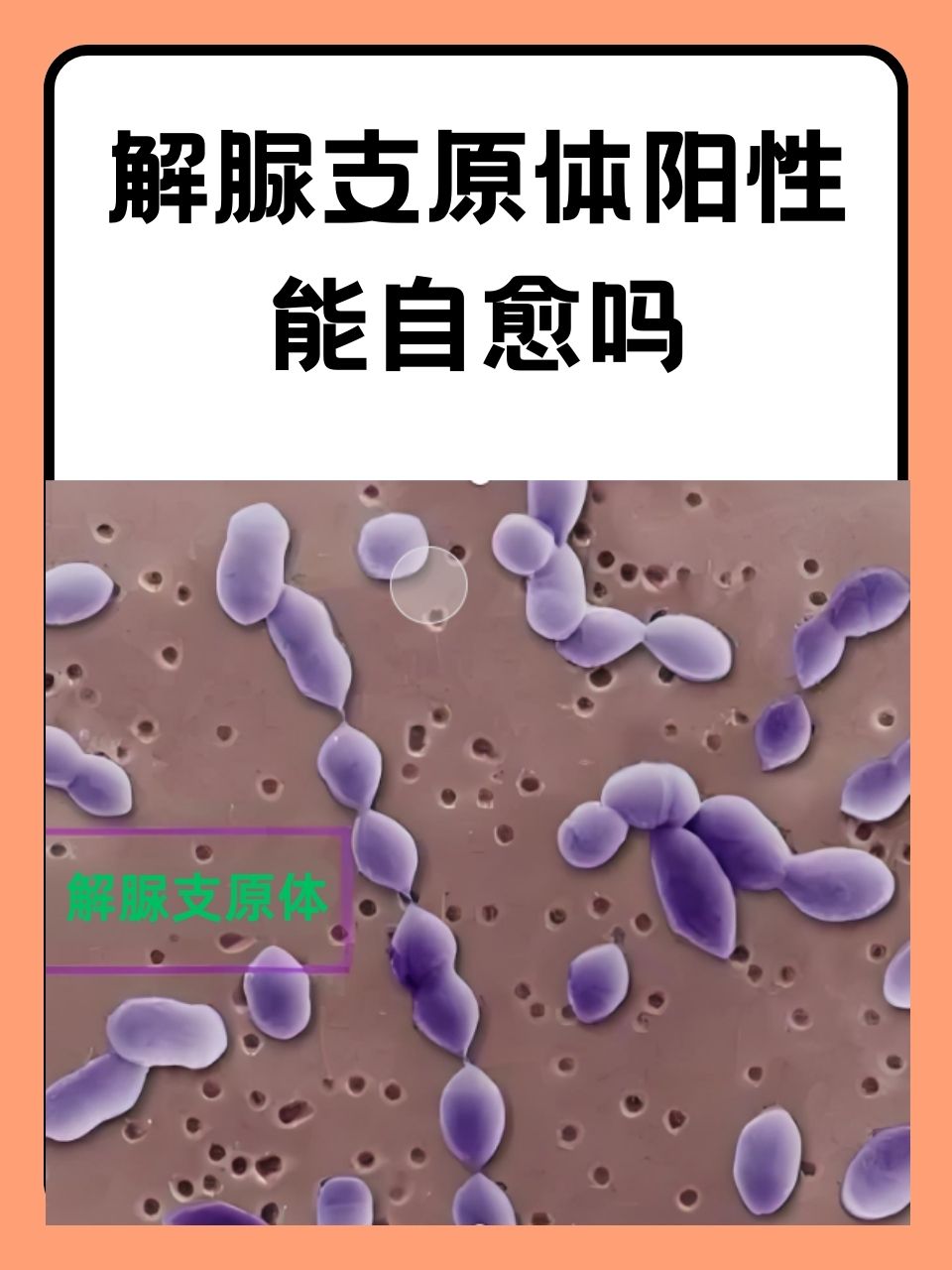 解脲支原体阳性是什么意思