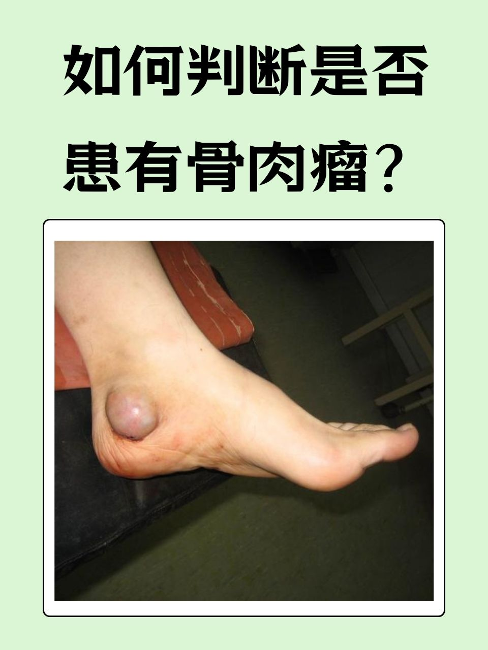 肿瘤是癌症吗
