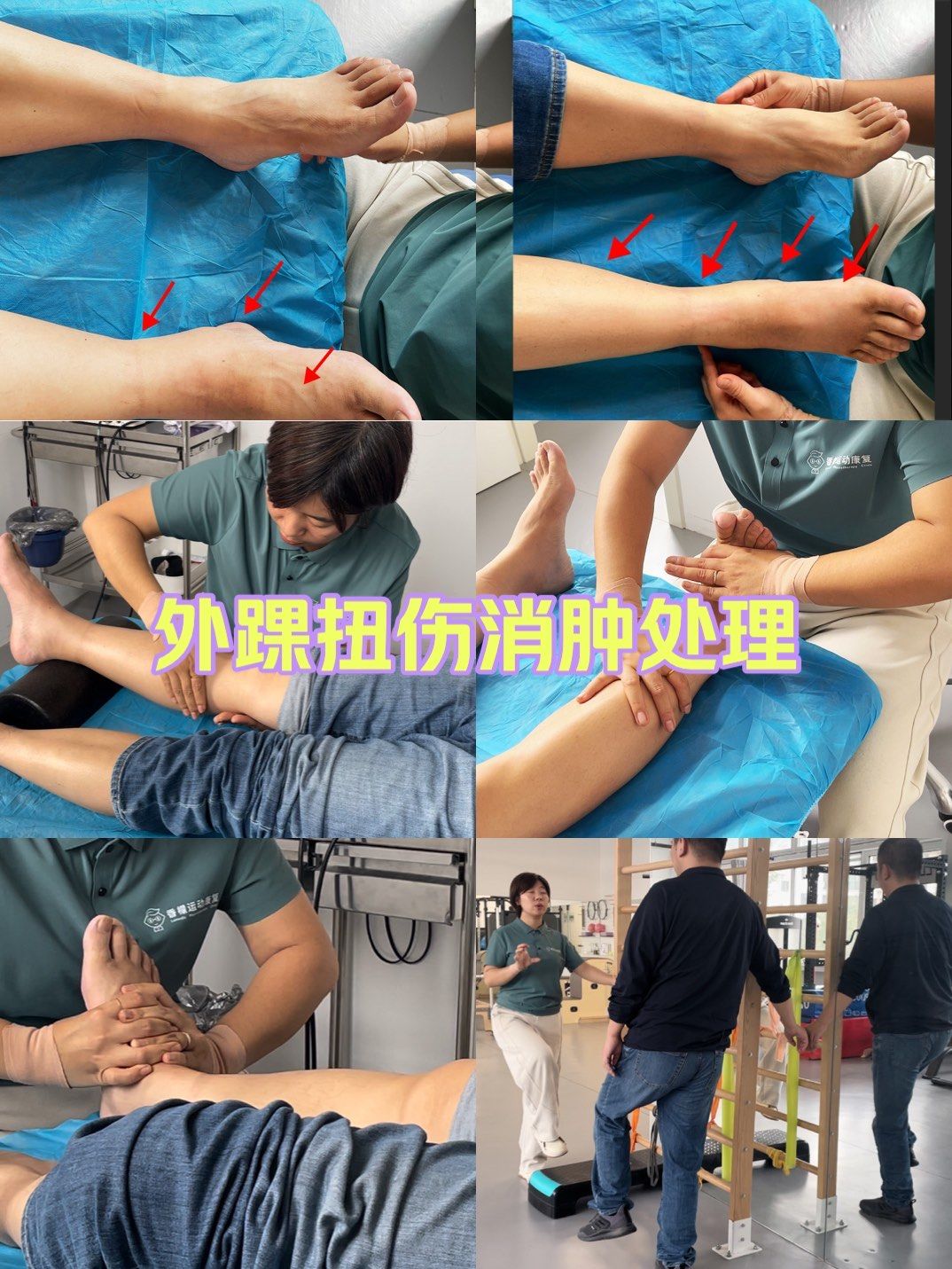 脚踝扭伤肿了怎么办?
