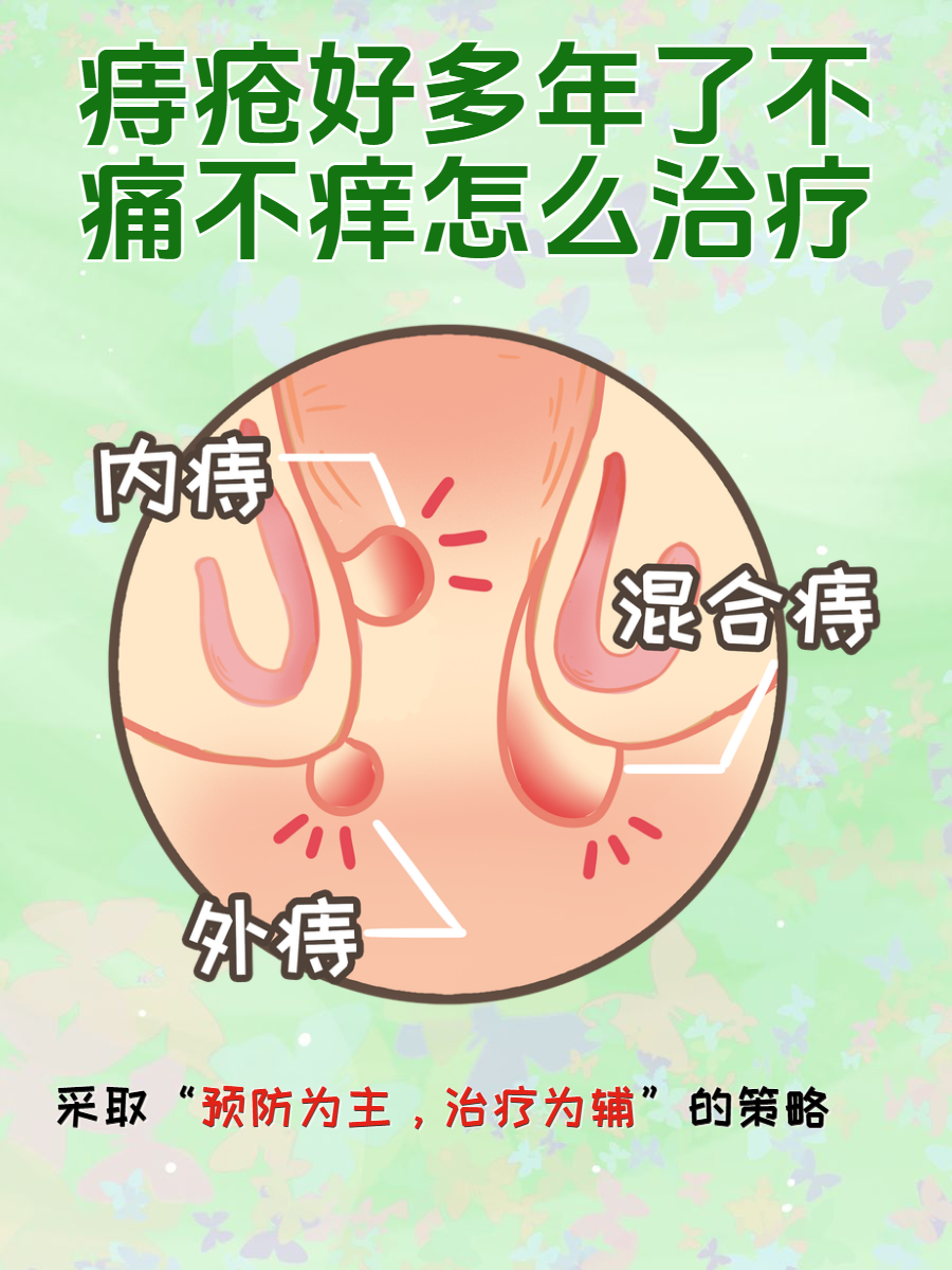 什么是痔疮