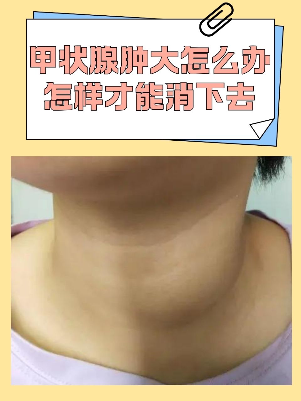 恭邵美 第3页