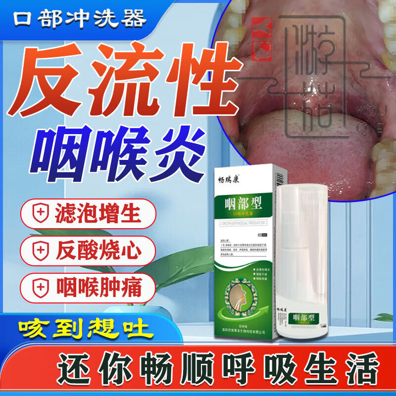 返流性咽喉炎,吃什么药好