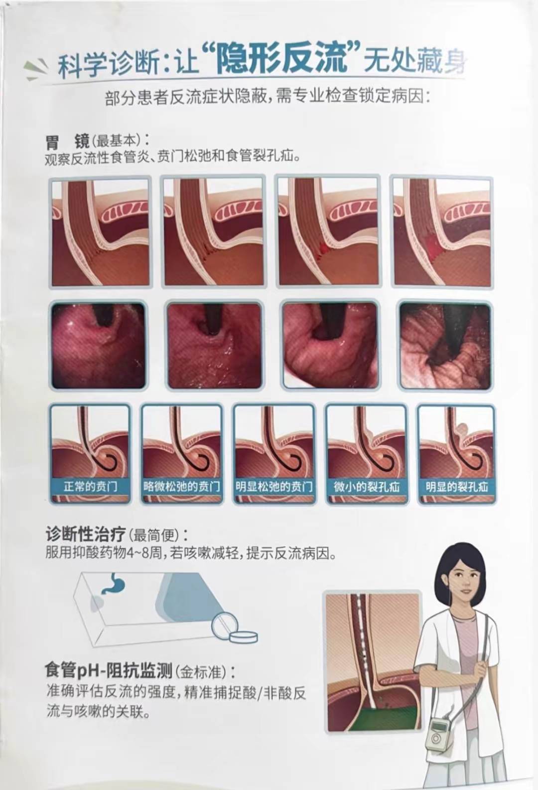胃食管反流病可以治愈吗?