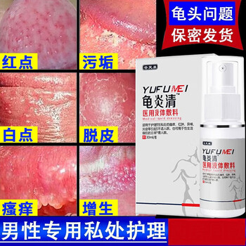 外阴部溃疡怎么治疗